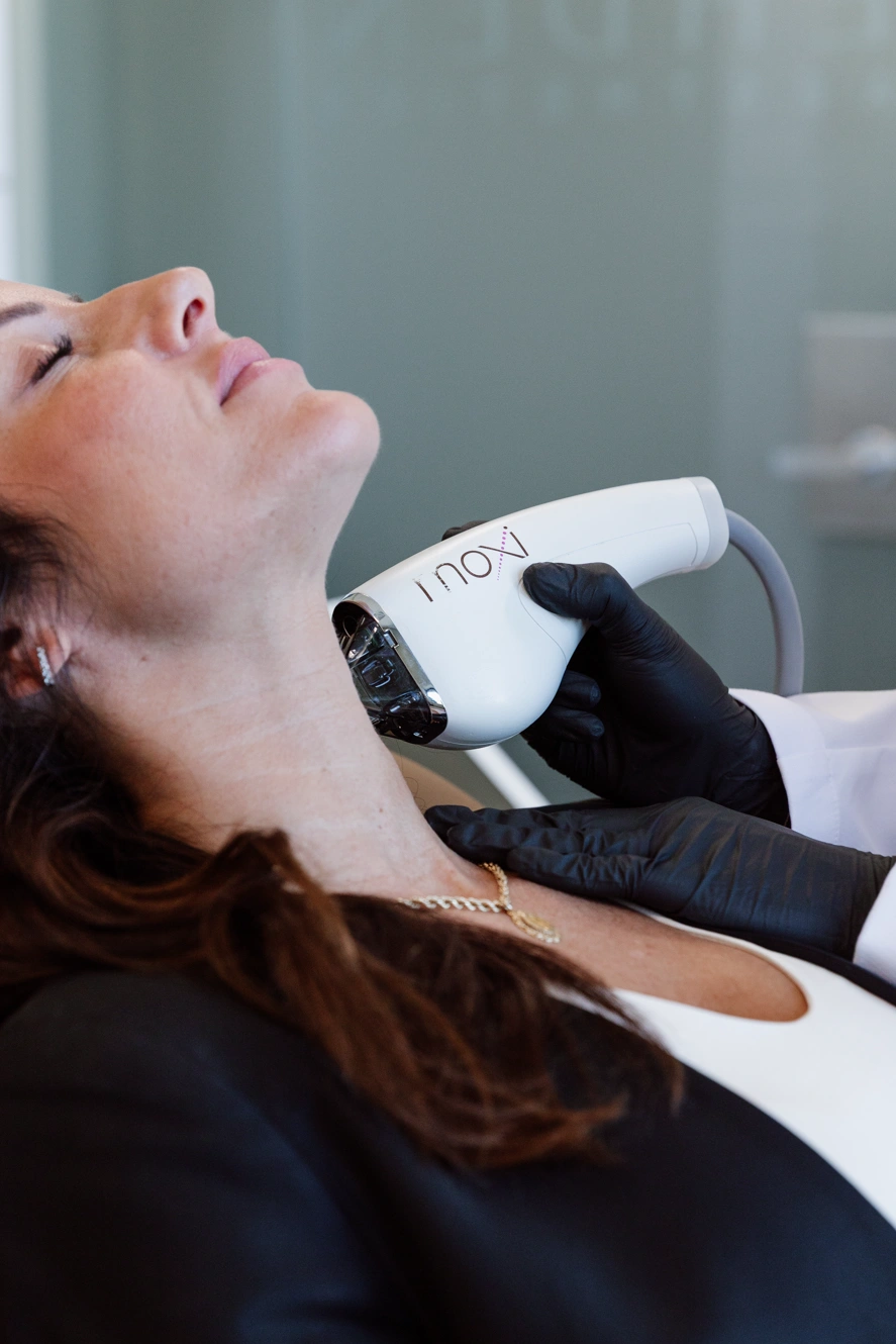 MOXI® Laser Treatment at Ehden Medical Aesthetics